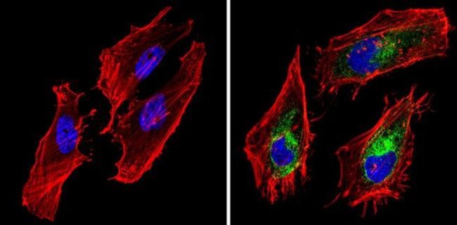 BAP31 Antibody in Immunocytochemistry (ICC/IF)