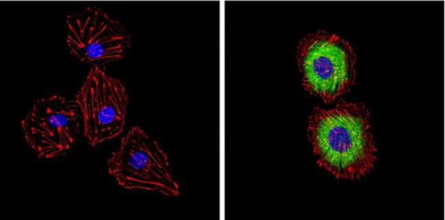 Endothelin 1 Monoclonal Antibody (TR.ET.48.5) (MA3-005)