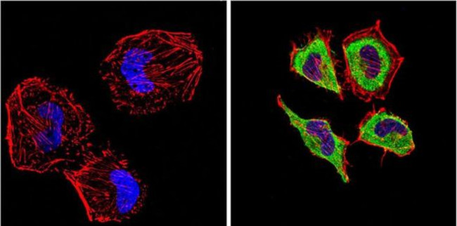 Endothelin 1 Monoclonal Antibody (TR.ET.48.5) (MA3-005)