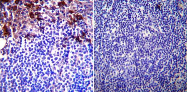 GRP94 Antibody in Immunohistochemistry (Paraffin) (IHC (P))