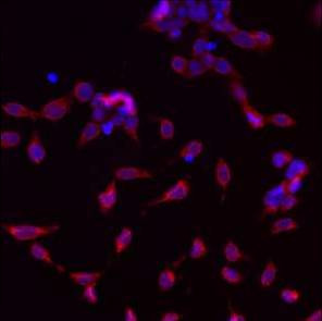 GRP94 Antibody in Immunocytochemistry (ICC/IF)