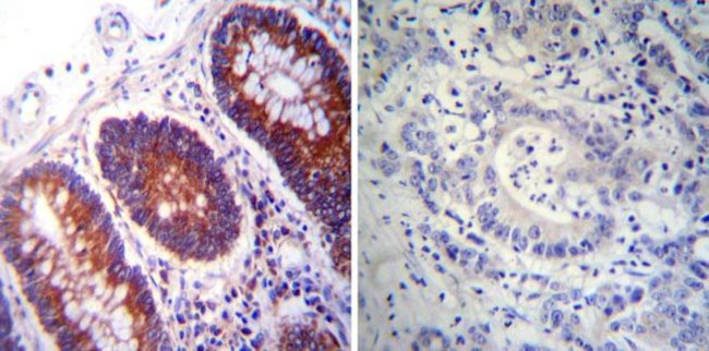 PDI Antibody in Immunohistochemistry (Paraffin) (IHC (P))