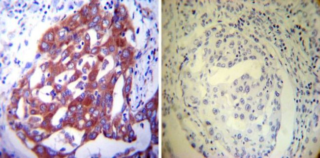 PDI Antibody in Immunohistochemistry (Paraffin) (IHC (P))