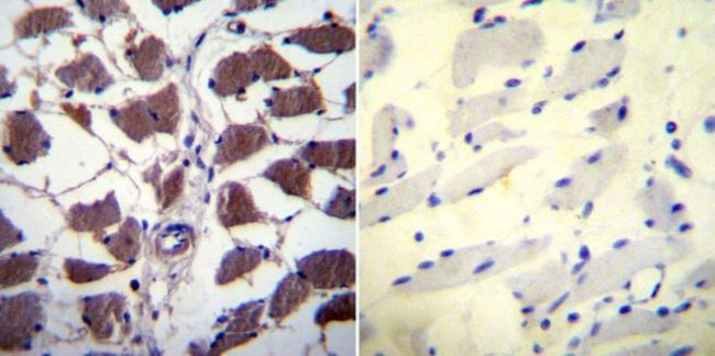 NFATC1 Antibody in Immunohistochemistry (Paraffin) (IHC (P))