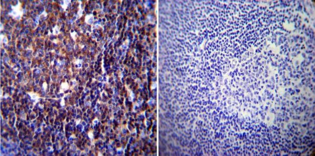 NFATC1 Antibody in Immunohistochemistry (Paraffin) (IHC (P))