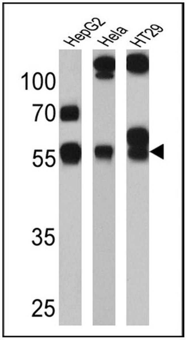 CYP3A7 Antibody in Western Blot (WB)