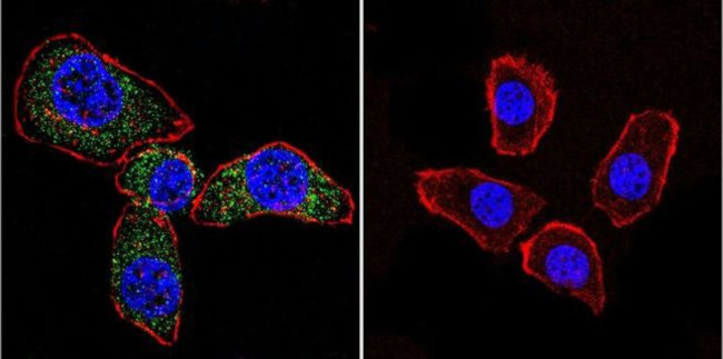 Acetylcholinesterase Antibody in Immunocytochemistry (ICC/IF)