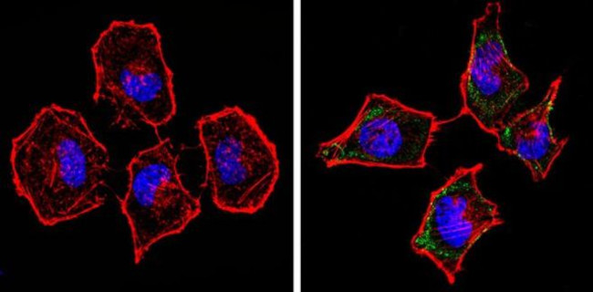 SPTBN1 Antibody in Immunocytochemistry (ICC/IF)