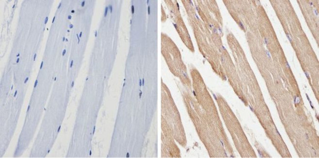 SPTBN1 Antibody in Immunohistochemistry (Paraffin) (IHC (P))