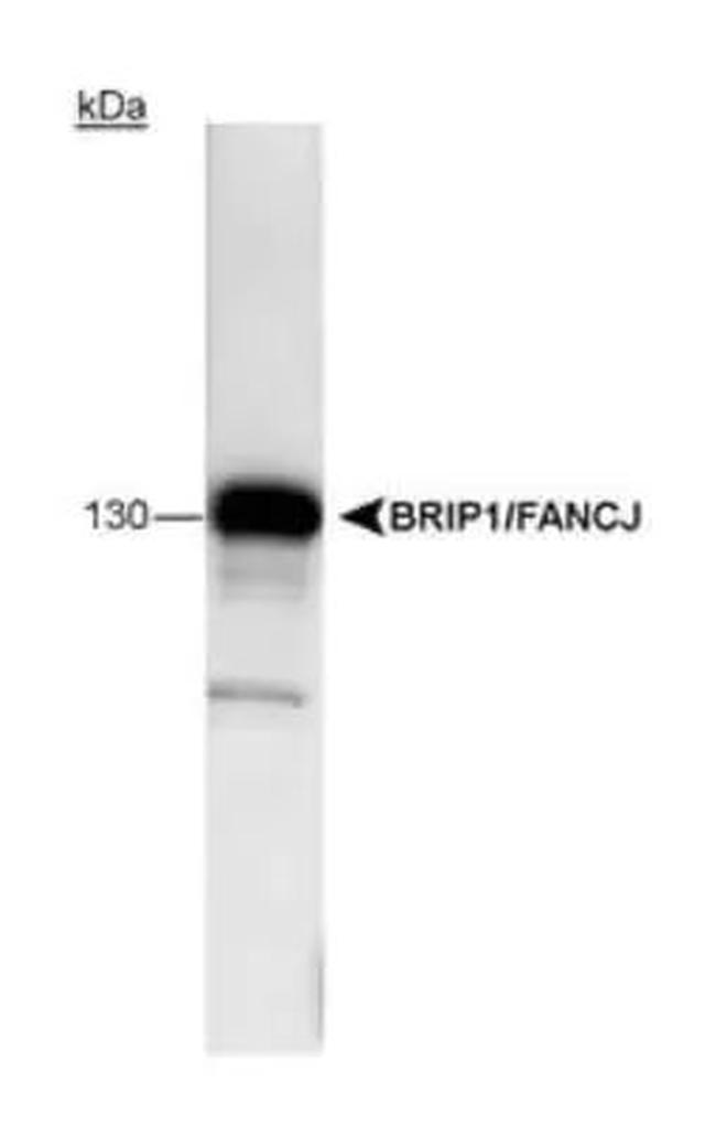 BRIP1 Antibody in Western Blot (WB)