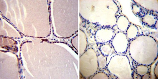 CRABP1 Antibody in Immunohistochemistry (Paraffin) (IHC (P))