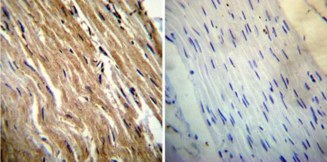 Calsequestrin Antibody in Immunohistochemistry (Paraffin) (IHC (P))