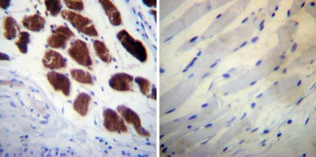 Calsequestrin Antibody in Immunohistochemistry (Paraffin) (IHC (P))