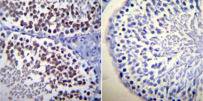 Calmodulin Antibody in Immunohistochemistry (Paraffin) (IHC (P))