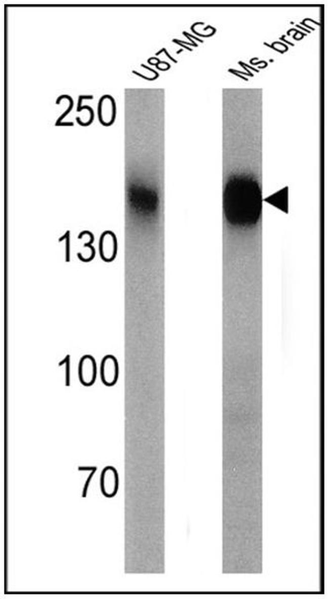 CACNA2D1 Monoclonal Antibody (20A) (MA3-921)