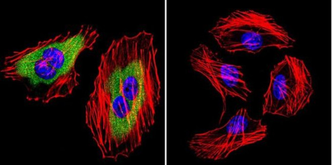 Calpain 2 Antibody in Immunocytochemistry (ICC/IF)