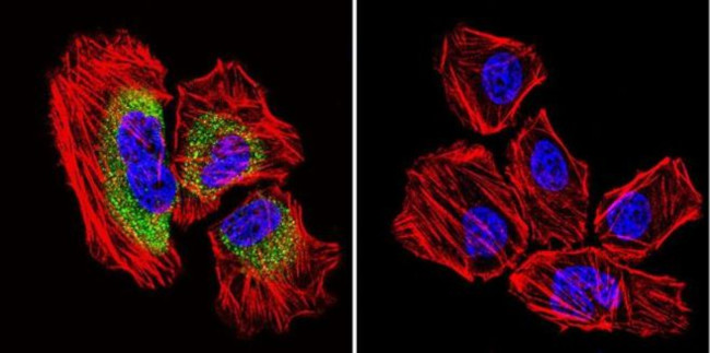 Calpain 2 Antibody in Immunocytochemistry (ICC/IF)