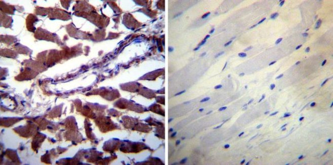 Calpastatin Antibody in Immunohistochemistry (Paraffin) (IHC (P))