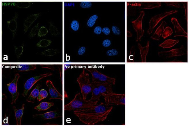 HSP70 Monoclonal Antibody (2A4) (MA3-008) - www.unidentalce.com.br