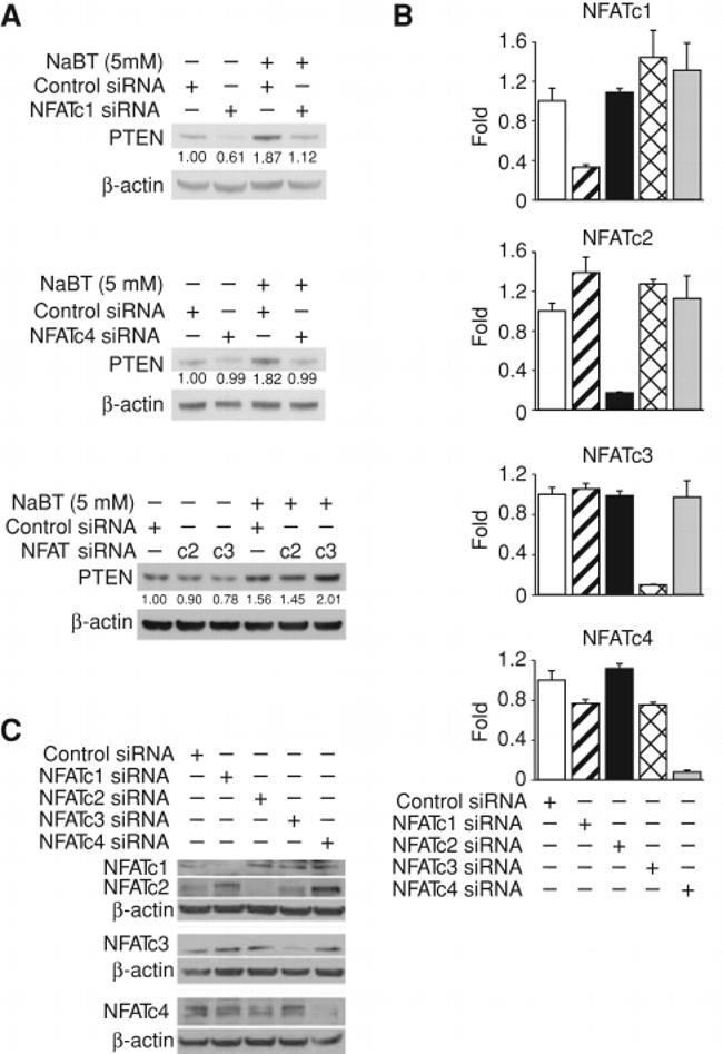 NFATC4 Antibody in Western Blot (WB)