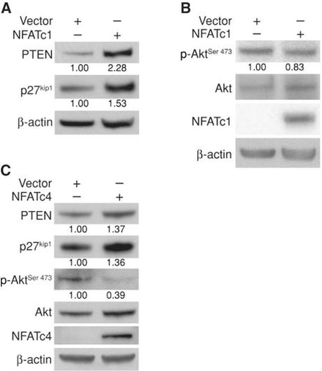 NFATC4 Antibody in Western Blot (WB)