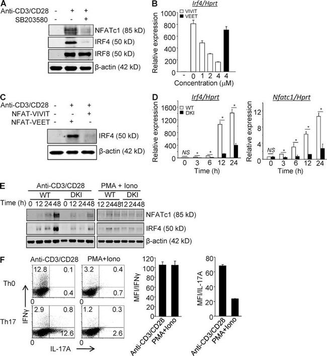 NFATC1 Antibody in Western Blot (WB)