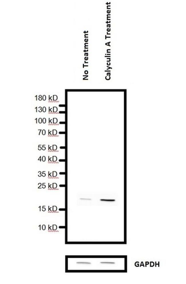 H3K9me2S10ph Antibody