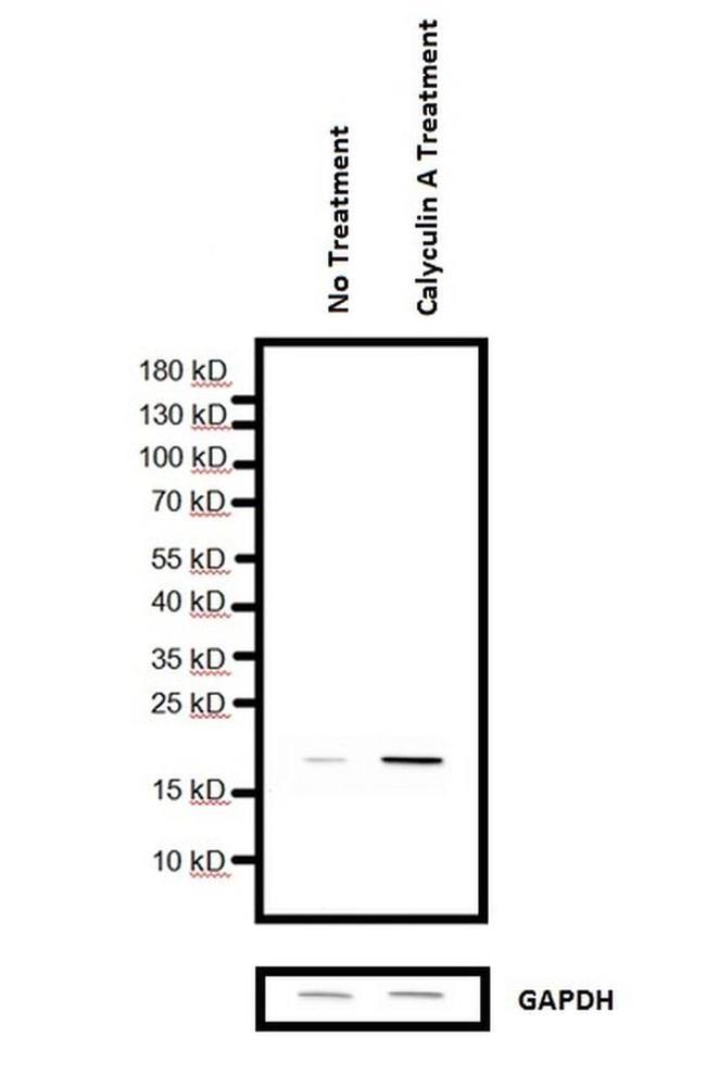 H3K9me2S10phK27me2S28ph Antibody