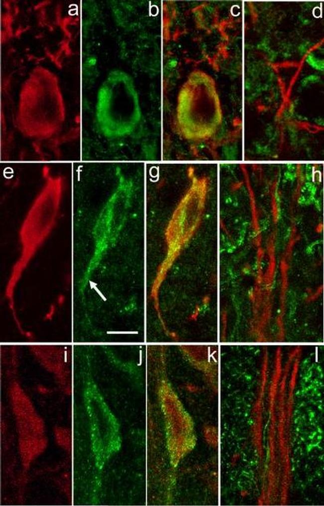 SERCA2 ATPase Antibody in Immunocytochemistry (ICC/IF)