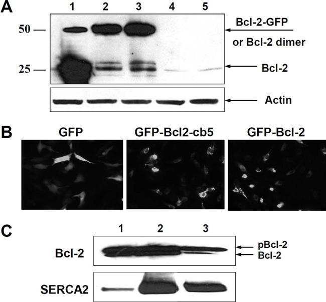 SERCA2 ATPase Antibody in Western Blot (WB)