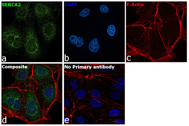 SERCA2 ATPase Antibody in Immunocytochemistry (ICC/IF)