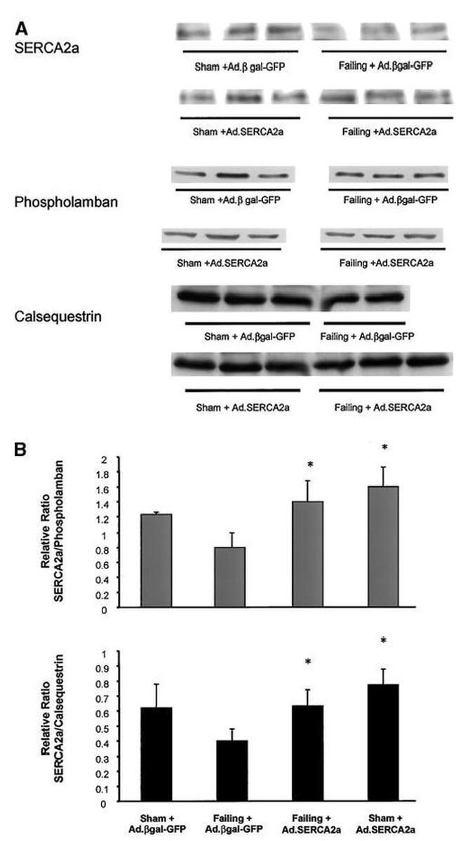 Calsequestrin Antibody in Western Blot (WB)