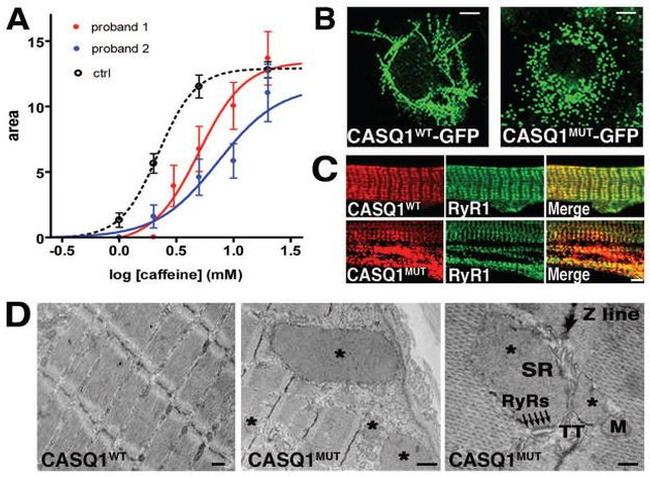 Calsequestrin Antibody in Immunohistochemistry (IHC)