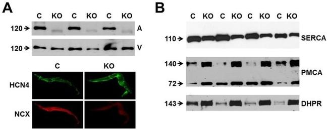 SERCA2 ATPase Antibody in Western Blot (WB)