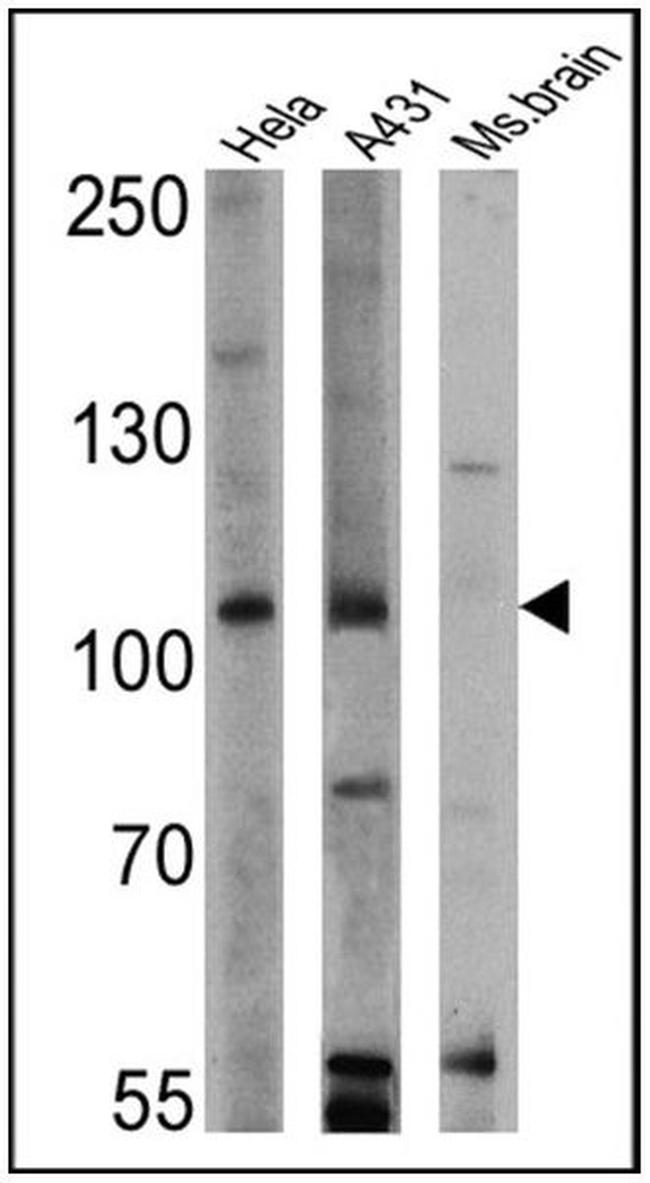 RASA1 Antibody in Western Blot (WB)