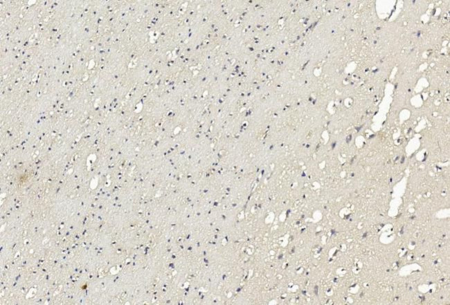 LRRK2 Antibody in Immunohistochemistry (Paraffin) (IHC (P))