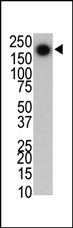 LRRK2 Antibody in Western Blot (WB)