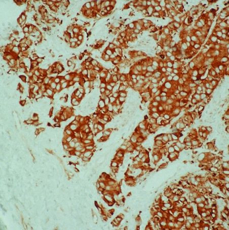 HSP27 Antibody in Immunohistochemistry (IHC)