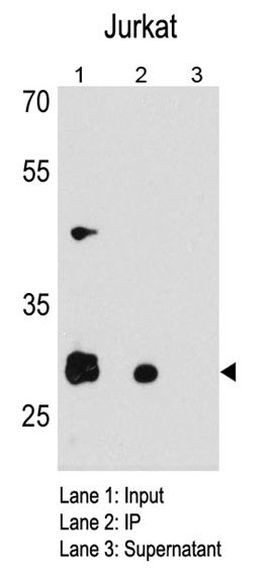 CDK5 Antibody in Immunoprecipitation (IP)