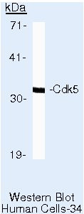 CDK5 Antibody in Western Blot (WB)