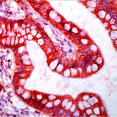 CD95 (APO-1/Fas) Antibody in Immunohistochemistry (IHC)