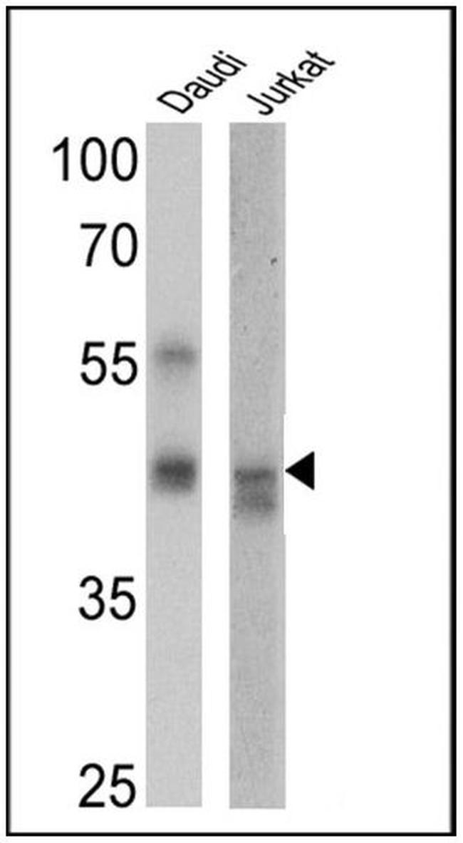 CD95 (APO-1/Fas) Antibody in Western Blot (WB)