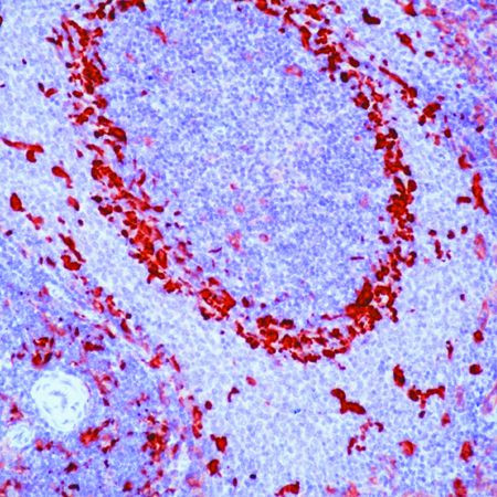 Fascin Antibody in Immunohistochemistry (Paraffin) (IHC (P))