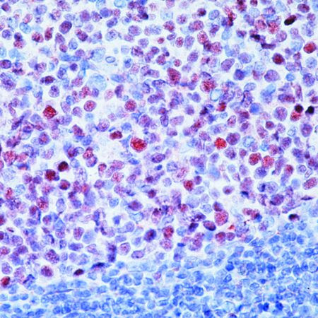 BCL6 Antibody in Immunohistochemistry (Paraffin) (IHC (P))