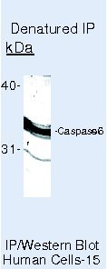 Caspase 6 Antibody in Immunoprecipitation (IP)