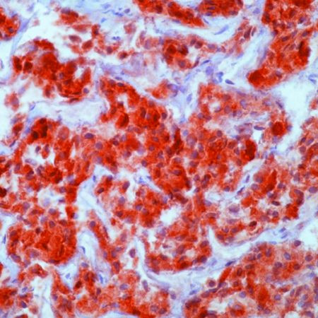 GnRHR Antibody in Immunohistochemistry (Paraffin) (IHC (P))