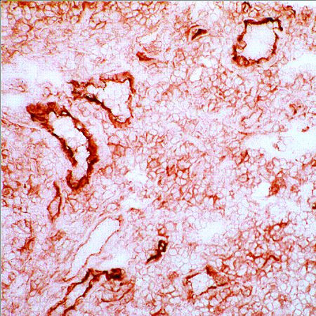 ICAM-1 Antibody in Immunohistochemistry (Frozen) (IHC (F))