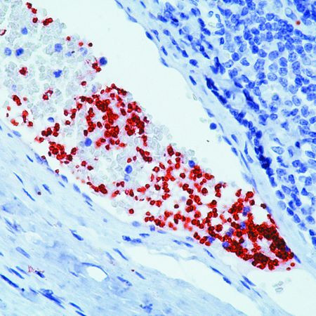 CD42b Antibody in Immunohistochemistry (Paraffin) (IHC (P))