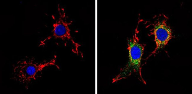 Survivin Antibody in Immunocytochemistry (ICC/IF)