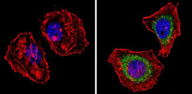 Survivin Antibody in Immunocytochemistry (ICC/IF)